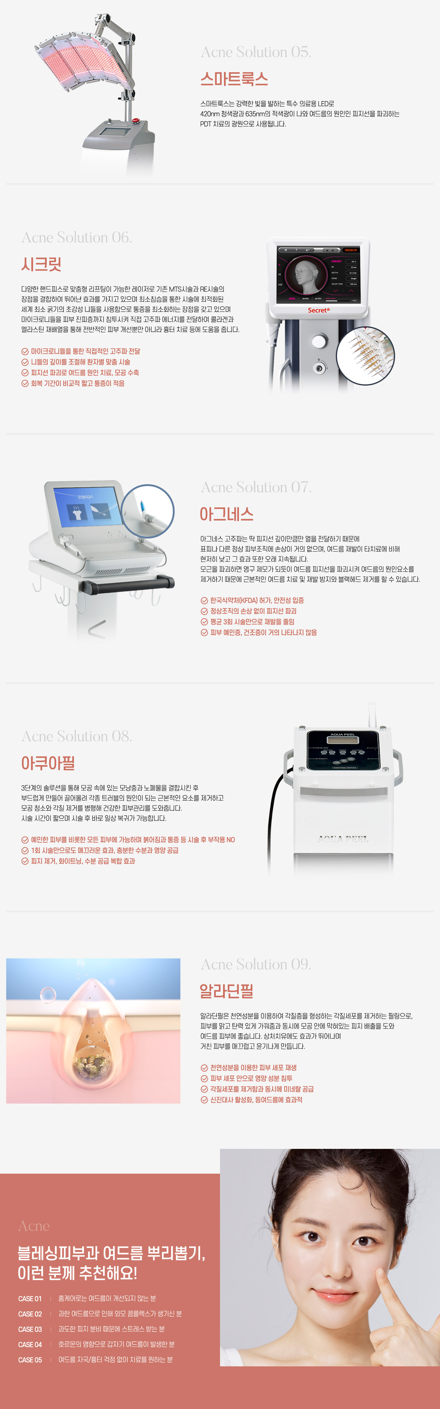 스마트룩스,시크릿,아그네스,아쿠아필,알라딘필