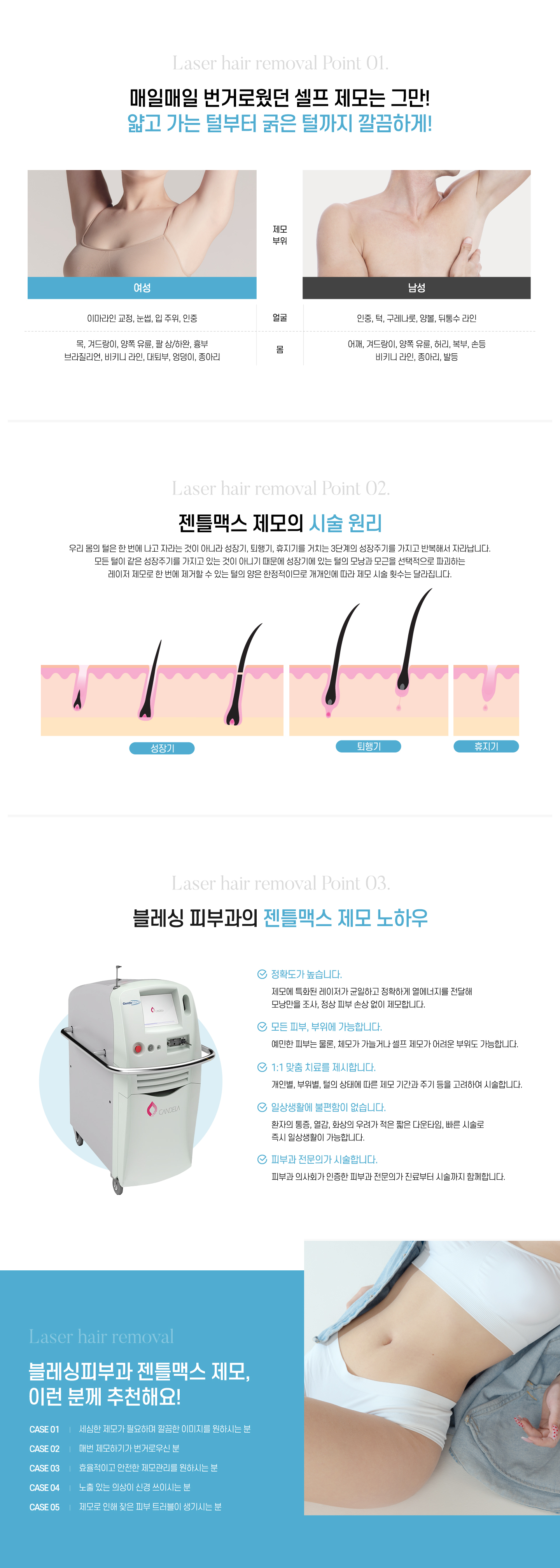 매일매일 번거로웠던 셀프 제모는 그만! 얇고 가는 털부터 굵은 털까지 깔끔하게!