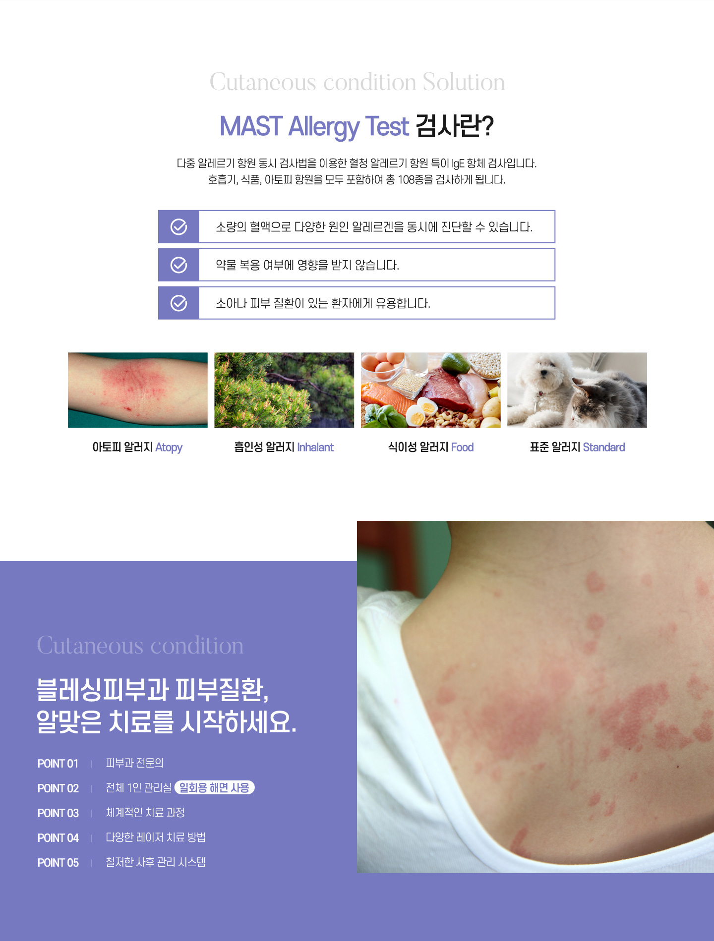 MAST Allergy Test검사