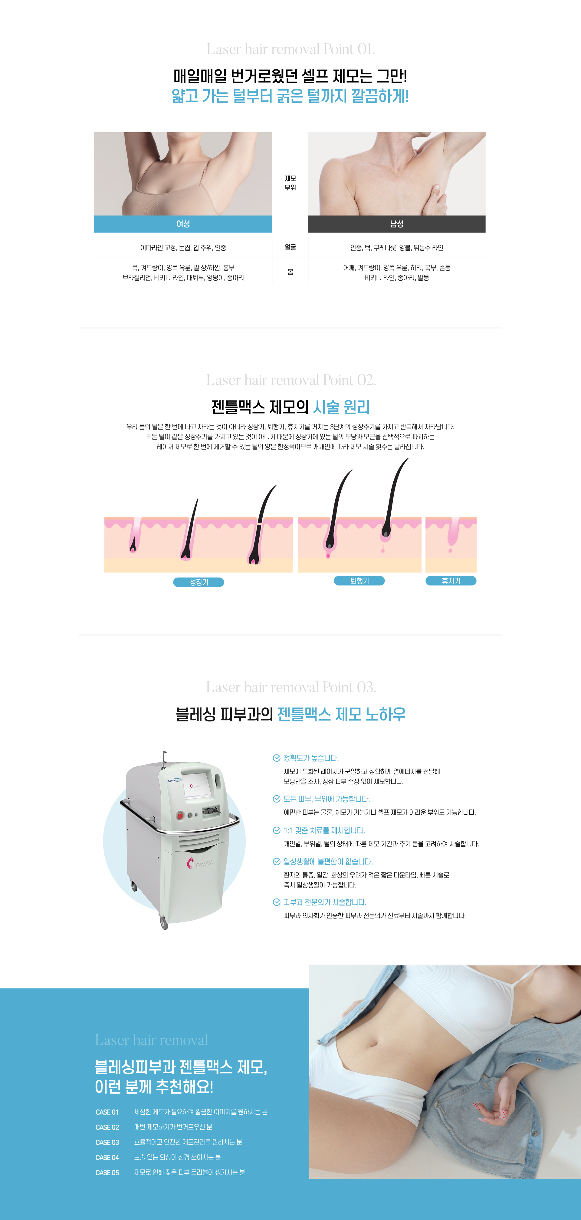 매일매일 번거로웠던 셀프 제모는 그만! 얇고 가는 털부터 굵은 털까지 깔끔하게!