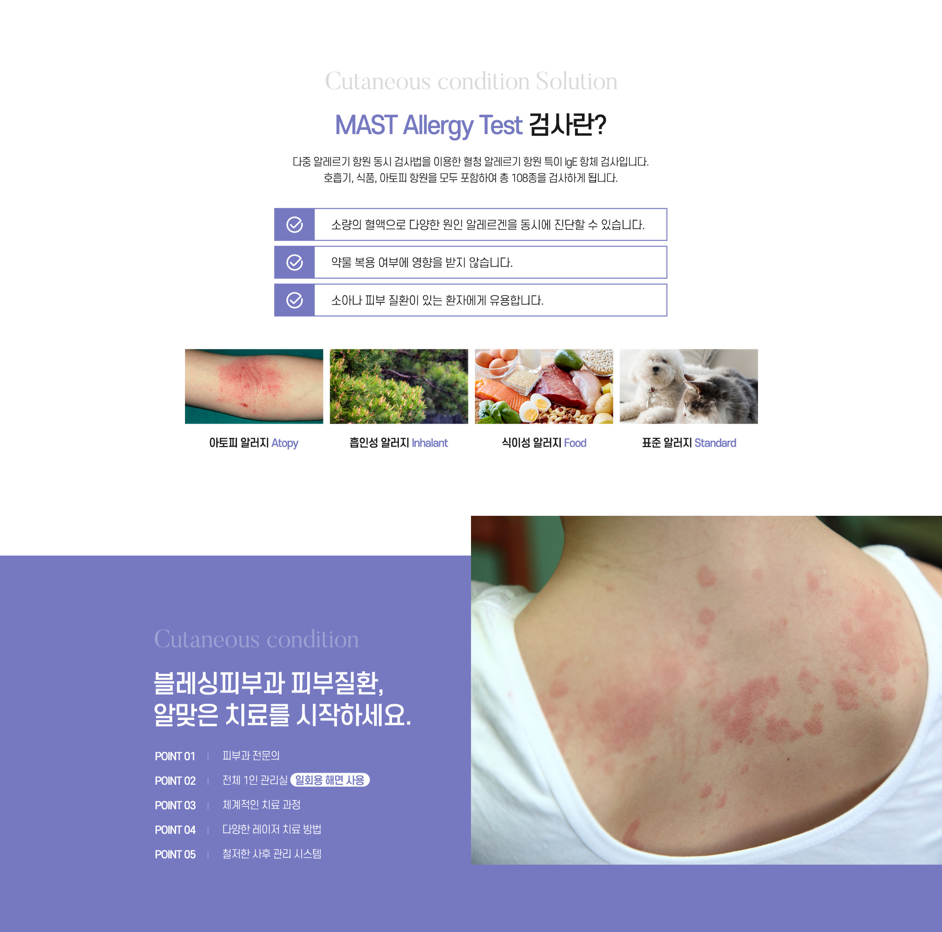 MAST Allergy Test검사